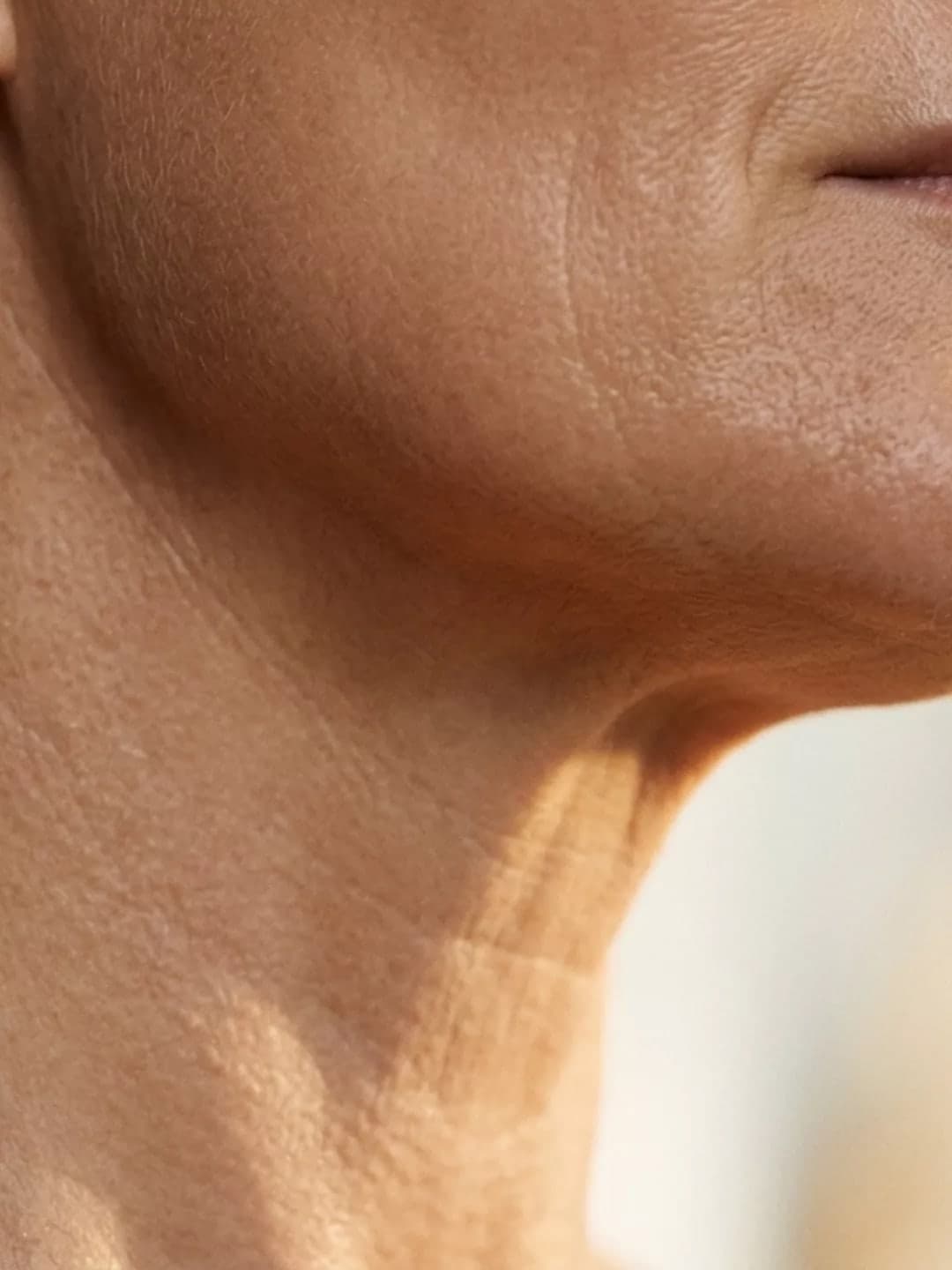Masseter Reduction